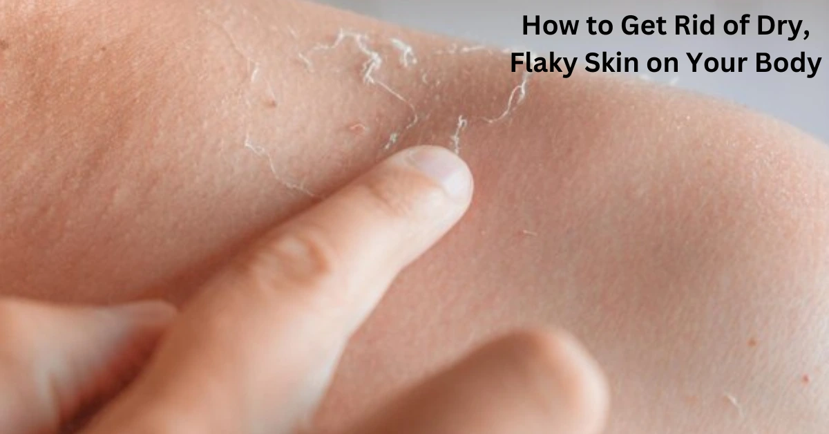 How to Get Rid of Dry, Flaky Skin on Your Body