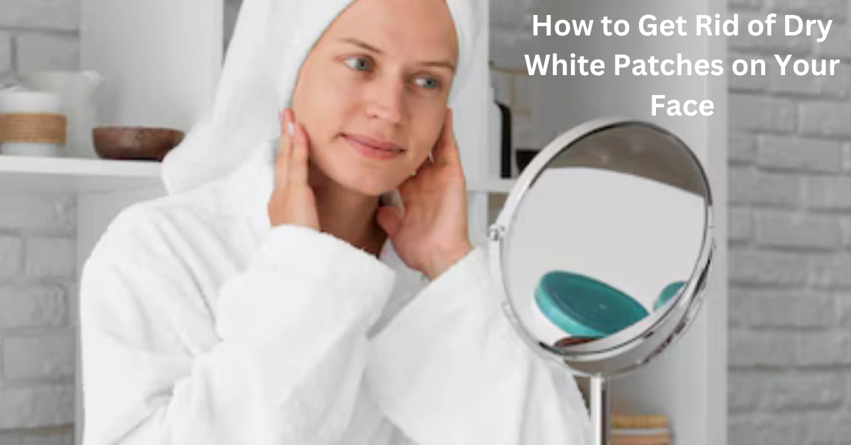 How to Get Rid of Dry White Patches on Your Face