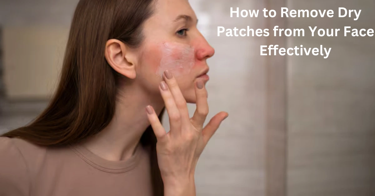 How to Remove Dry Patches from Your Face Effectively